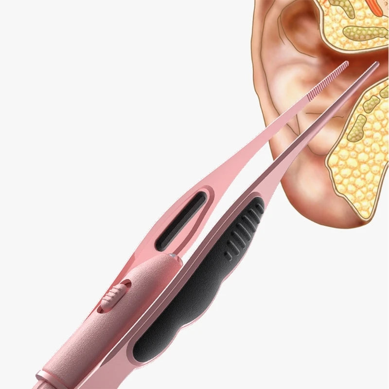 LED Ear Wax Removal Tweezers Anti-Skid Ear Pick Tool with Brightness Light Ear Curette Safety Earwax Cleaning Tool